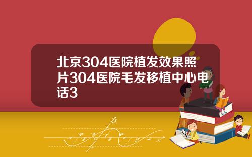 北京304医院植发效果照片304医院毛发移植中心电话3