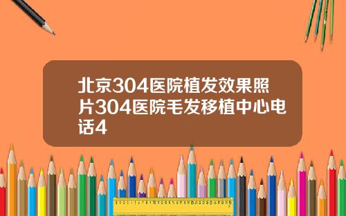 北京304医院植发效果照片304医院毛发移植中心电话4