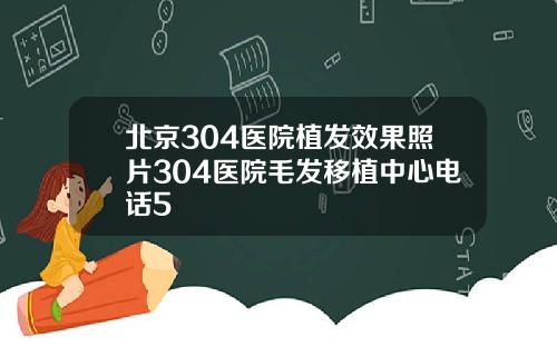 北京304医院植发效果照片304医院毛发移植中心电话5